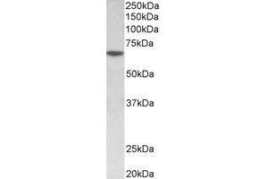 Western Blotting (WB) image for anti-SRY (Sex Determining Region Y)-Box 11 (SOX11) (Internal Region) antibody (ABIN2464999) (SOX11 antibody  (Internal Region))