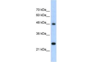 Western Blotting (WB) image for anti-Chromogranin A (CHGA) antibody (ABIN2462501)