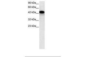 Image no. 2 for anti-Eyes Absent Homolog 3 (EYA3) (AA 277-326) antibody (ABIN6735802) (EYA3 antibody  (AA 277-326))