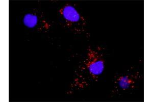 Proximity Ligation Analysis of protein-protein interactions between BAD and MAPK8. (JNK antibody  (AA 1-384))