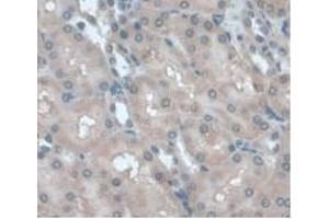 Detection of a1AGP in Rat Kidney Tissue using Monoclonal Antibody to Alpha-1-Acid Glycoprotein (a1AGP) (ORM1 antibody  (AA 20-186))