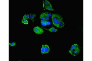 Immunofluorescent analysis of MCF-7 cells using ABIN7164439 at dilution of 1:100 and Alexa Fluor 488-congugated AffiniPure Goat Anti-Rabbit IgG(H+L) (Midline 2 antibody  (AA 506-735))
