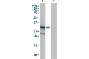 Lane 1: C1QTNF2 transfected lysate ( 30 KDa). (C1QTNF2 HEK293 Cell Transient Overexpression Lysate(Non-Denatured))