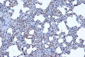 Immunohistochemistry of paraffin-embedded rat lung using JunD Rabbit mAb (ABIN7268051) at dilution of 1:100 (40x lens). (JunD antibody)