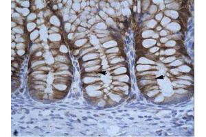Image no. 1 for anti-Suppressor of Variegation 3-9 Homolog 1 (Drosophila) (SUV39H1) (C-Term) antibody (ABIN202465) (SUV39H1 antibody  (C-Term))