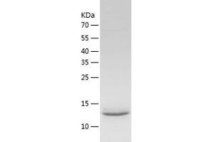 Western Blotting (WB) image for ATPase, H+ Transporting, Lysosomal 14kDa, V1 Subunit F (ATP6V1F) (AA 1-119) protein (His tag) (ABIN7287390) (ATP6V1F Protein (AA 1-119) (His tag))