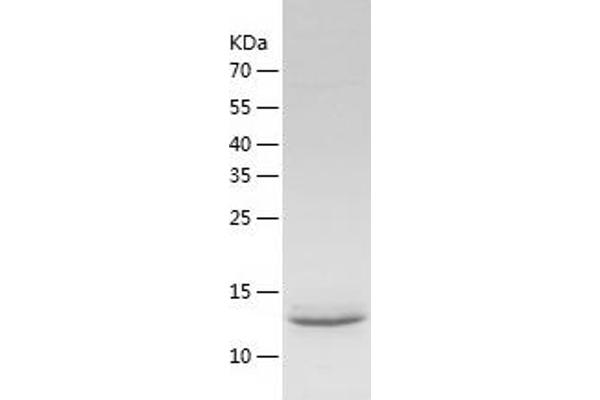 ATP6V1F Protein (AA 1-119) (His tag)