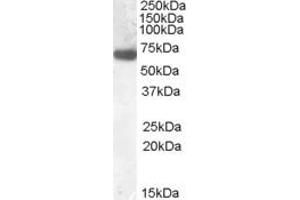 EB09275 (0. (GCKR antibody  (N-Term))
