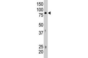 SMURF2 anticorps  (AA 702-731)