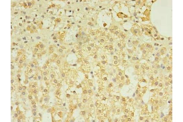TREML2 antibody  (AA 19-268)