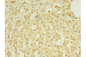 Immunohistochemistry of paraffin-embedded human adrenal gland tissue using ABIN7173349 at dilution of 1:100 (TREML2 antibody  (AA 19-268))