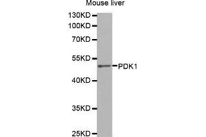 PDPK1 anticorps  (AA 1-150)