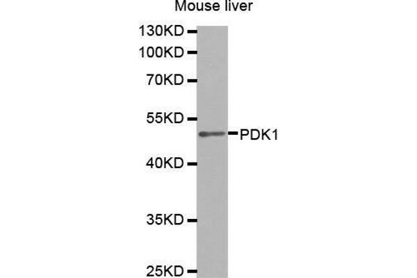 PDPK1 抗体  (AA 1-150)