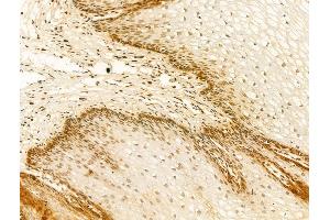 ABIN7094280 and ABIN7098327 at 1/100 staining Human normal tissues adjacent to esophageal cancer by IHC-P. (HNRNPR antibody  (C-Term))