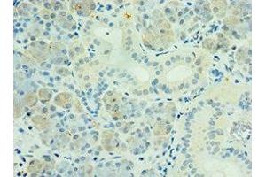 Immunohistochemistry of paraffin-embedded human pancreatic tissue using ABIN7169136 at dilution of 1:100 (PAK6 antibody  (AA 1-270))