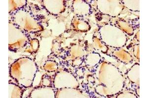 Immunohistochemistry of paraffin-embedded human thyroid tissue using ABIN7159100 at dilution of 1:100 (MED1 antibody  (AA 878-1031))