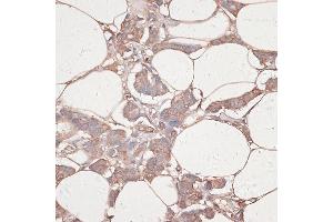Immunohistochemistry (IHC) image for anti-Laminin, gamma 1 (LAMC1) (AA 1300-1609) antibody (ABIN7268186)