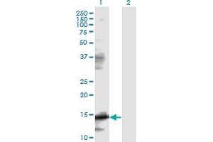 Western Blot analysis of EIF5A expression in transfected 293T cell line by EIF5A monoclonal antibody (M01), clone 8C1.
