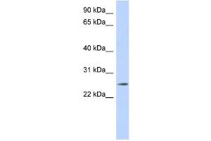 WB Suggested Anti-NKAIN4 Antibody Titration: 0. (NKAIN4 antibody  (Middle Region))