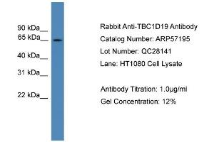 WB Suggested Anti-TBC1D19  Antibody Titration: 0. (TBC1D19 antibody  (Middle Region))