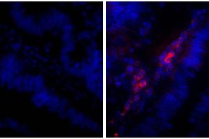 Paraffin embedded human gastric cancer tissue was stained with Rabbit IgG-UNLB isotype control and DAPI. (Rabbit anti-Human IgG Antibody (Alkaline Phosphatase (AP)))