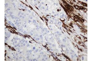 Image no. 4 for anti-Sex Determining Region Y (SRY) antibody (ABIN1501140)