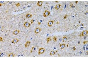 Immunohistochemistry of paraffin-embedded Rat brain using OLR1 Polyclonal Antibody at dilution of 1:200 (40x lens). (OLR1 antibody)