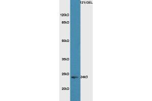 Lane 1: Mouse Macrophages probed with Rabbit Anti-HMGB1 Polyclonal Antibody, Unconjugated  at 1:5000 for 90 min at 37˚C. (HMGB1 antibody  (AA 75-170))