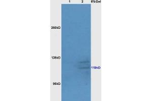 Lane 1: mouse liver lysates Lane 2: mouse brain lysates probed with Anti Bub1 Polyclonal Antibody, Unconjugated (ABIN706541) at 1:200 in 4 °C. (BUB1 antibody  (AA 951-1085))