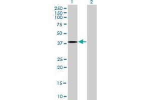 Western Blot analysis of IL4R expression in transfected 293T cell line by IL4R MaxPab polyclonal antibody. (IL4 Receptor antibody  (AA 1-227))