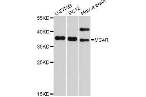 Western blot analysis of extracts of various cell lines, using MC4R Antibody. (MC4R antibody  (AA 1-100))