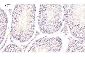 Detection of IL25 in Mouse Testis Tissue using Polyclonal Antibody to Interleukin 25 (IL25) (IL-25 antibody  (AA 32-148))