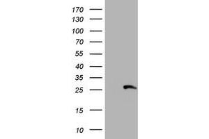 Western Blotting (WB) image for anti-Regulatory Factor X-Associated Ankyrin Containing Protein (RFXANK) antibody (ABIN1500683) (RFXANK antibody)