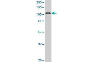KIAA1967 monoclonal antibody (M04), clone 4E6 Western Blot analysis of KIAA1967 expression in A-549 . (CCAR2 antibody  (AA 5-365))