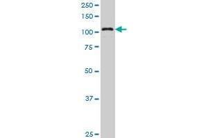 KIAA1967 monoclonal antibody (M04), clone 4E6 Western Blot analysis of KIAA1967 expression in A-549 .