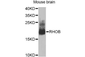 Western blot analysis of extracts of mouse brain, using RHOB Antibody. (RHOB antibody)