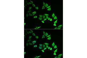 Immunofluorescence analysis of U2OS cells using MYOZ2 antibody (ABIN6129772, ABIN6144299, ABIN6144300 and ABIN6222126). (MYOZ2 antibody  (AA 1-264))