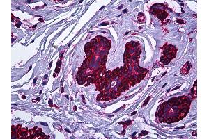 Anti-MYH9 antibody IHC of human breast. (Myosin 9 antibody)