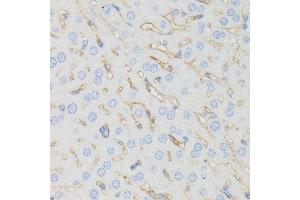 Immunohistochemistry (IHC) image for anti-Interferon-Induced Transmembrane Protein 1 (IFITM1) (C-Term) antibody (ABIN1680390)