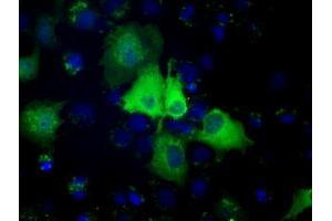 Anti-PSMC3 mouse monoclonal antibody (ABIN2453538) immunofluorescent staining of COS7 cells transiently transfected by pCMV6-ENTRY PSMC3 (RC201790). (PSMC3 antibody)