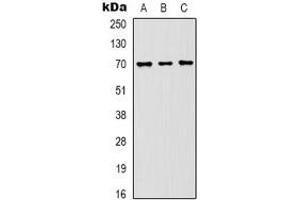 Western blot analysis of HSC70 expression in Hela (A), mouse brain (B), rat brain (C) whole cell lysates. (Hsc70 antibody)