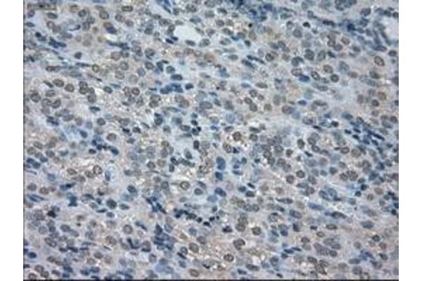 BUB1B antibody