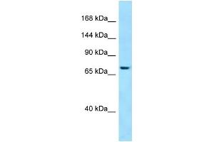 WB Suggested Anti-SBF1 Antibody Titration: 1. (SBF1 antibody  (C-Term))
