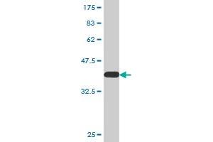 Western Blot detection against Immunogen (37. (ZNF181 antibody  (AA 354-461))