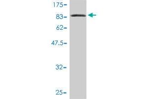 Western Blot detection against Immunogen (84. (L3MBTL4 antibody  (AA 1-534))