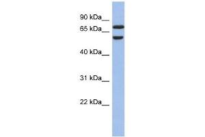 GNL3L antibody used at 1 ug/ml to detect target protein. (GNL3L antibody)