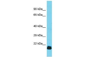 Host: Rabbit  Target Name: Gpx7  Sample Tissue: Rat Heart lysates  Antibody Dilution: 1. (Glutathione Peroxidase 7 antibody  (C-Term))