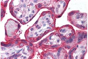 Human Placenta (formalin-fixed, paraffin-embedded) stained with EGFR antibody ABIN218581 at 1:500 followed by biotinylated goat anti-rabbit IgG secondary antibody ABIN481713, alkaline phosphatase-streptavidin and chromogen. (EGFR antibody  (AA 1166-1180))
