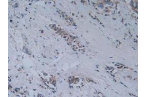 Immunohistochemistry (IHC) image for anti-Myelin Associated Glycoprotein (MAG) (AA 133-237) antibody (ABIN7431770)