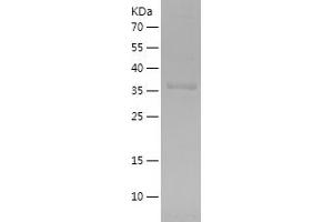 FGL2 Protein (AA 26-178) (His-IF2DI Tag)